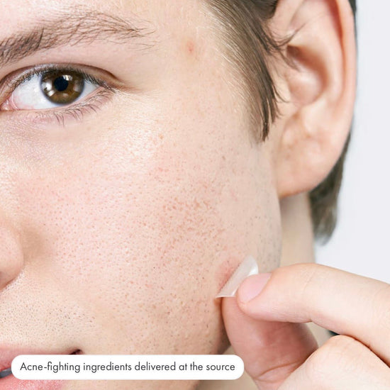 Hero Cosmetics Micropoint for Blemishes (8 Patches). هيرو كوزمتيكس ميكرو بوينت للعيوب (8 لصقات) - Princess Cosmetics Qatar