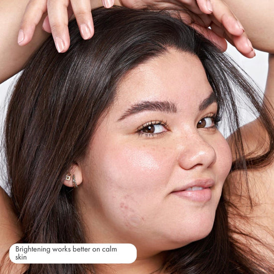 Hero Cosmetics Micropoint for Dark Spots (6 Patches). هيرو كوزمتكس ميكرو بوينت للبقع الداكنة (6 لصقات) - Princess Cosmetics Qatar