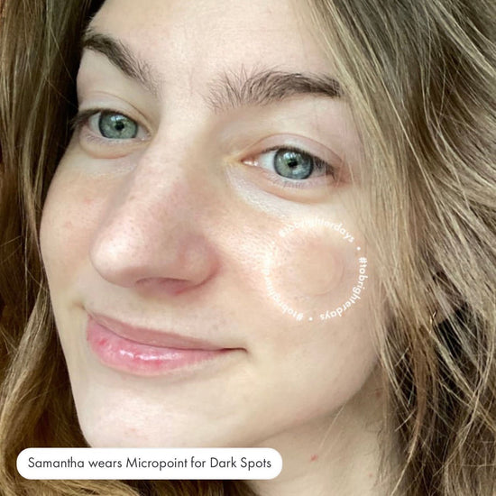 Hero Cosmetics Micropoint for Dark Spots (6 Patches). هيرو كوزمتكس ميكرو بوينت للبقع الداكنة (6 لصقات) - Princess Cosmetics Qatar