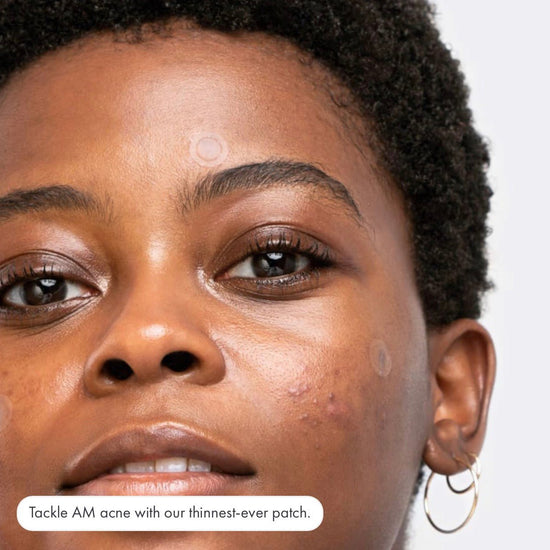 Hero Cosmetics Mighty Patch Invisible+ (39 Patches). هيرو كوزمتيكس مايتي باتش إنفيزيبل+ (39 رقعة) - Princess Cosmetics Qatar