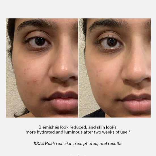 Peach & Lily Glass Skin Refining Serum 40ml. بيچ اند ليلي سيروم تنقية البشرة الزجاجي 40 مل - Princess Cosmetics Qatar