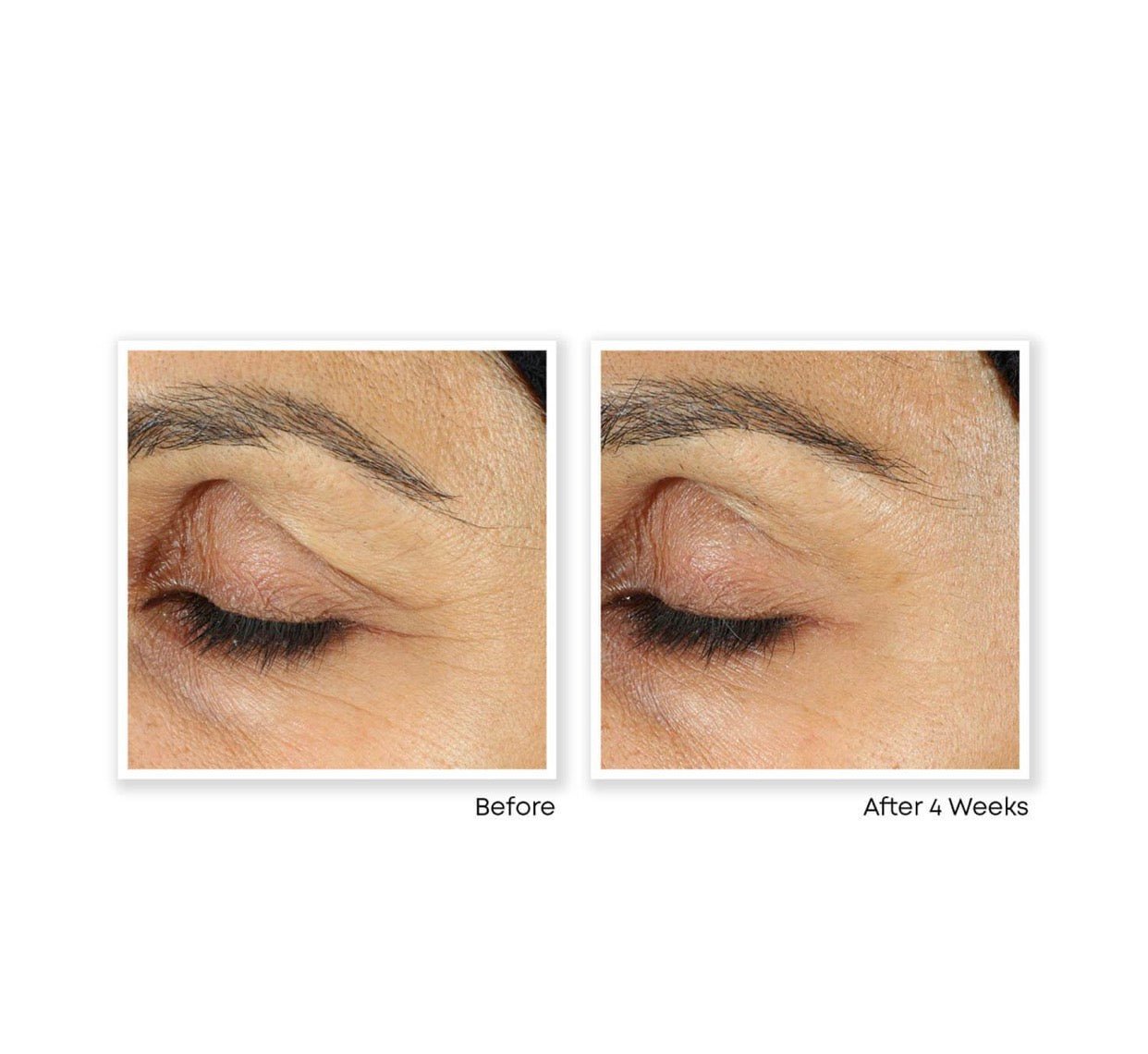 ROC Retinol Correxion Eye Cream 15ml. روس ريتينول كوريكسيون كريم العين 15 مل - Princess Cosmetics Qatar