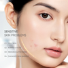 Skintific Sensitive Moisture Gel 40ml جل ترطيب البشرة الحساسة من سكينتيفيك
