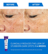Cerave Skin Renewing Brightening Lotion with Sunscreen 40ml سيرافي لوشن مُجدِّد ومُفتِّح للبشرة مع واقي من الشمس