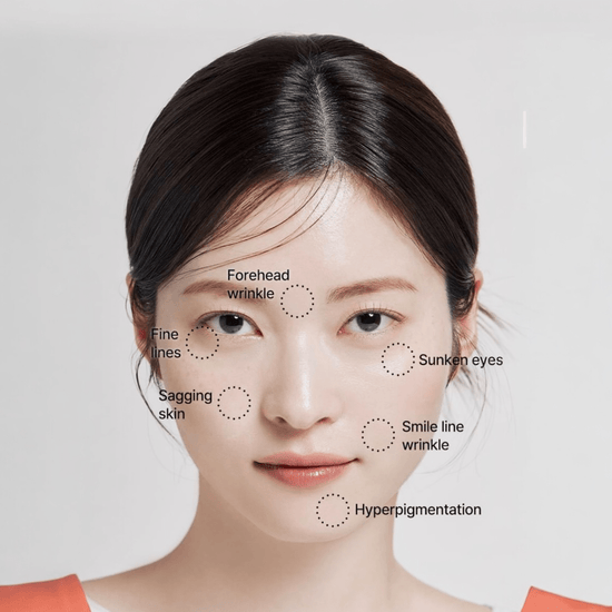 AcroPass Retinol Reti - RN Microcone Patch (T - Shaped) لاصقة أكروباس ريتينول ريتي - آر إن مايكروكون - Princess Cosmetics Qatar