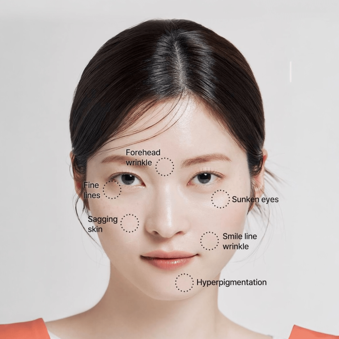 AcroPass Retinol Reti - RN Microcone Patch (T - Shaped) لاصقة أكروباس ريتينول ريتي - آر إن مايكروكون - Princess Cosmetics Qatar