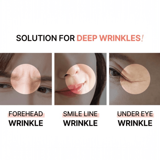 AcroPass Retinol Reti - RN Microcone Patch (T - Shaped) لاصقة أكروباس ريتينول ريتي - آر إن مايكروكون - Princess Cosmetics Qatar