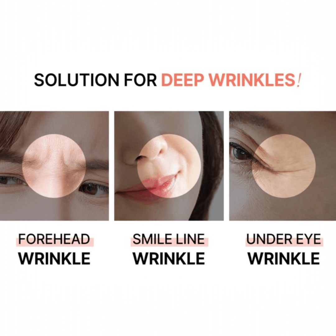 AcroPass Retinol Reti - RN Microcone Patch (T - Shaped) لاصقة أكروباس ريتينول ريتي - آر إن مايكروكون - Princess Cosmetics Qatar