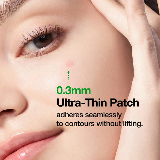 Anua Triple Acid Spot Care Microdart Patch (12 Patches) رقعة أنوا تريبل أسيد للعناية بالبقع - Princess Cosmetics Qatar