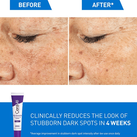 Cerave Skin Renewing Brightening Lotion with Sunscreen 40ml سيرافي لوشن مُجدِّد ومُفتِّح للبشرة مع واقي من الشمس - Princess Cosmetics Qatar