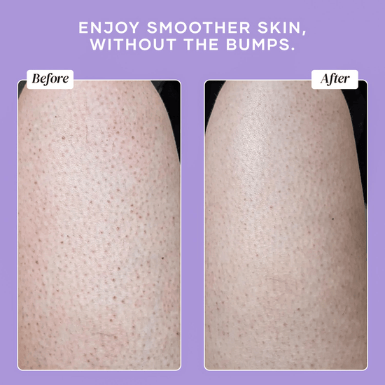 DERMAdoctor KP Duty Body Scrub 237ml مقشر الجسم ديرما دكتور كي بي ديوتي - Princess Cosmetics Qatar