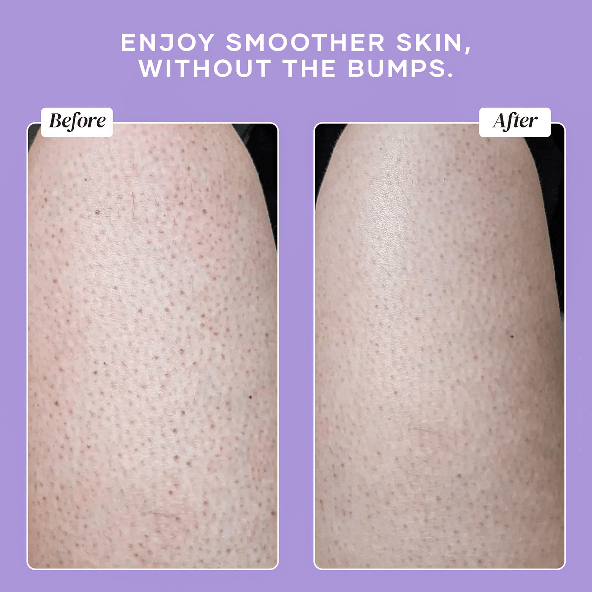 DERMAdoctor KP Duty Body Scrub 237ml مقشر الجسم ديرما دكتور كي بي ديوتي - Princess Cosmetics Qatar