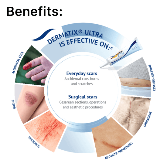 Dermatix Ultra Gel Advanced Scar Formula 15g ديرماتيكس ألترا جل تركيبة متطورة للندبات - Princess Cosmetics Qatar