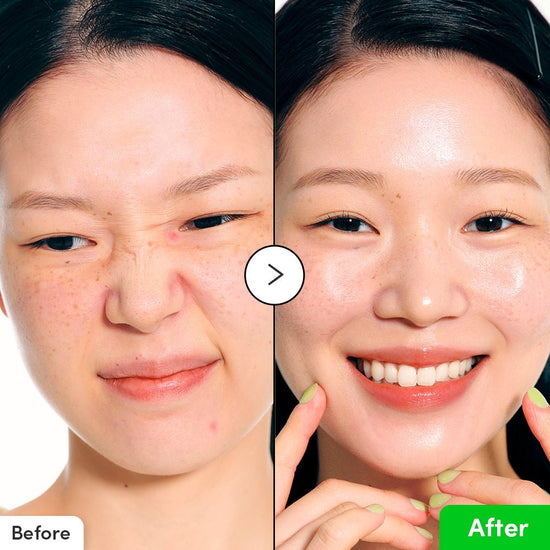 Eqqualberry Aloe PDRN Calming Serum 30ml إكوالبيري سيروم مهدئ بالألوة وPDRN - Princess Cosmetics Qatar