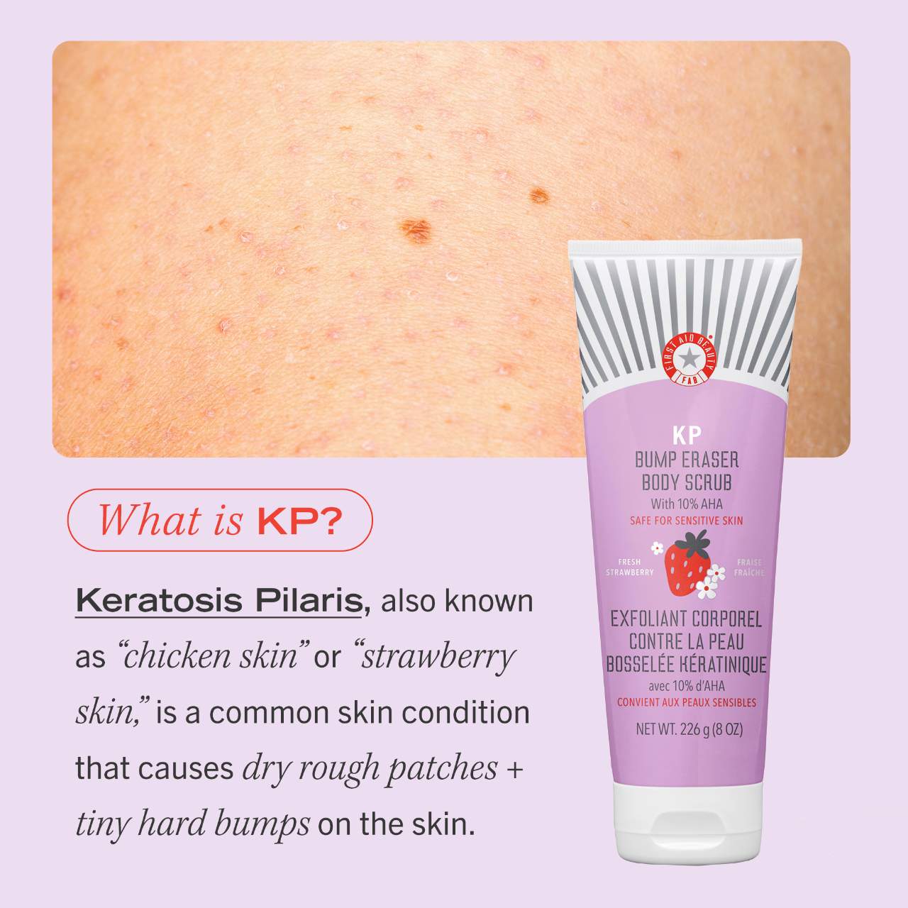 First Aid Beauty KP Bump Eraser Body Scrub 10% AHA Fresh Strawberry 226g مقشر الجسم لإزالة النتوءات من الإسعافات الأولية للتجميل KP بخلاصة الفراولة الطازجة وحمض ألفا هيدروكسي 10% - Princess Cosmetics Qatar