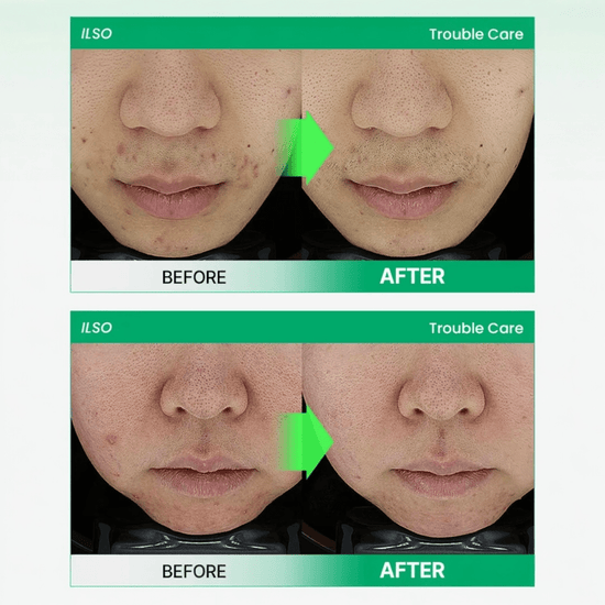 ilso No Problem Spot Softener 150g منعم البقع بدون مشاكل - Princess Cosmetics Qatar