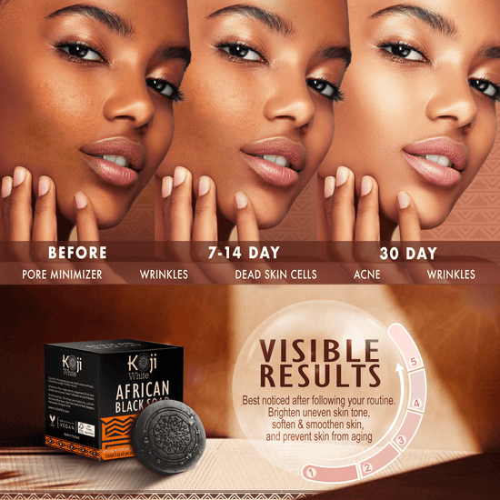 Koji White African Black Soap Bar (80g x 2) صابون كوجي وايت الأفريقي الأسود - Princess Cosmetics Qatar