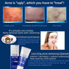 Lion Acne Pair Creamy Foam 80g ليون لعلاج حب الشباب، كريم رغوي مزدوج - Princess Cosmetics Qatar