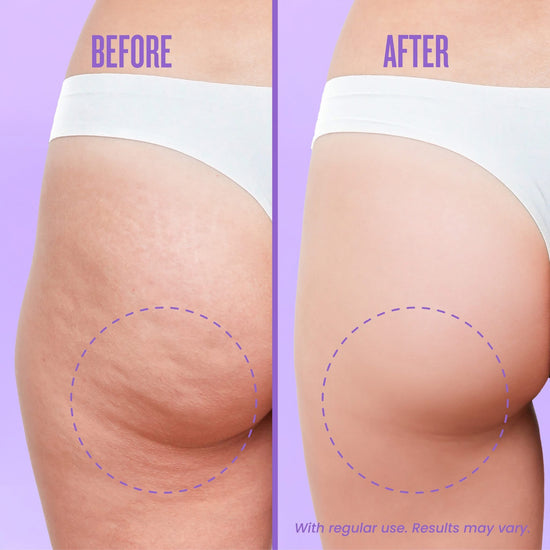 Luxe Organix Bye Bye Bum Bumps Clear & Firm Cellulite Cream 230g كريم لوكس أورجانيكس باي باي بامبس كلير آند فيرم لعلاج السيلوليت - Princess Cosmetics Qatar