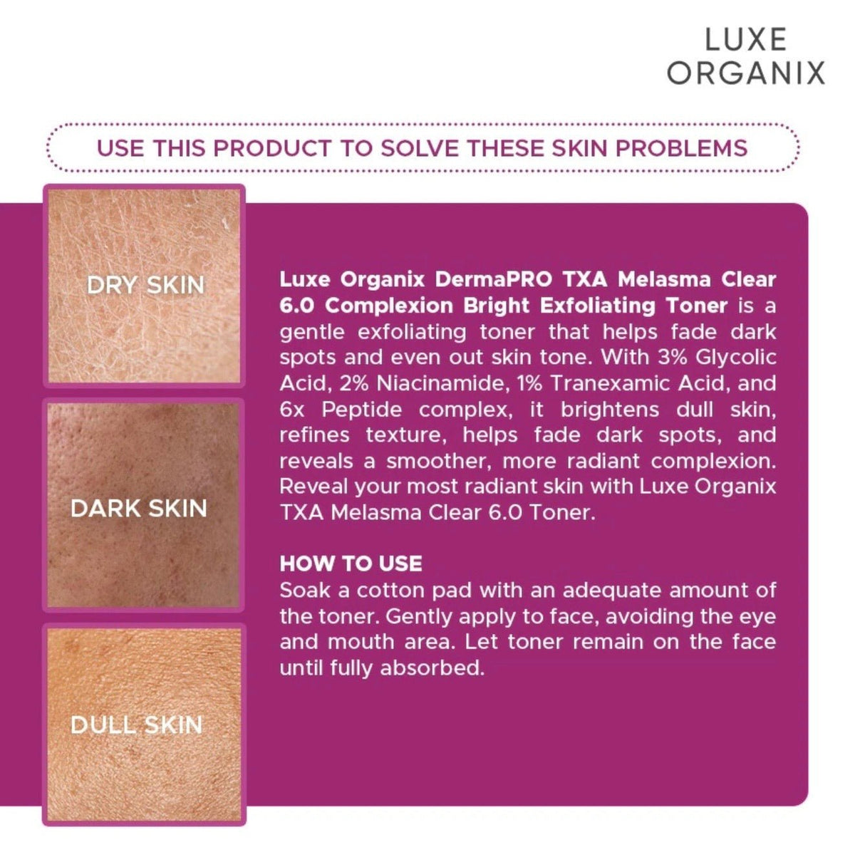 Luxe Organix Derma PRO TXA Melasma Clear 6.0 Complexion Bright Exfoliating Toner 150ml تونر مقشر ومفتح للبشرة من لوكس أورجانيكس ديرما برو تي إكس إيه لعلاج الكلف 6.0 - Princess Cosmetics Qatar