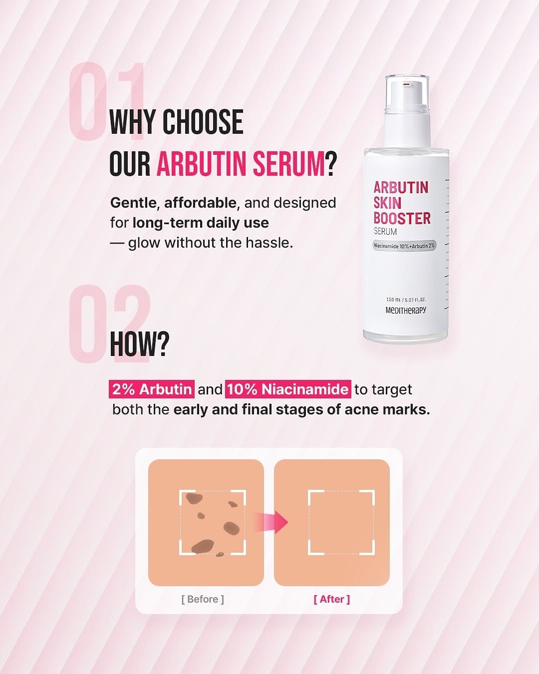 Meditherapy Arbutin Skin Booster Serum 150ml سيروم أربوتين لتعزيز البشرة من ميديثيرابي - Princess Cosmetics Qatar