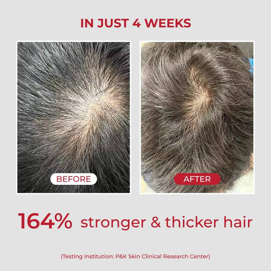 Moev Annurcatin Shampoo 300ml شامبو مويف أنوركاتين - Princess Cosmetics Qatar