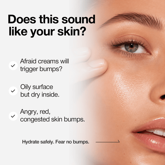 Nineless A-Control Azelaic Acid Cream 50ml كريم حمض الأزيليك ناينليس أ كونترول - Princess Cosmetics Qatar