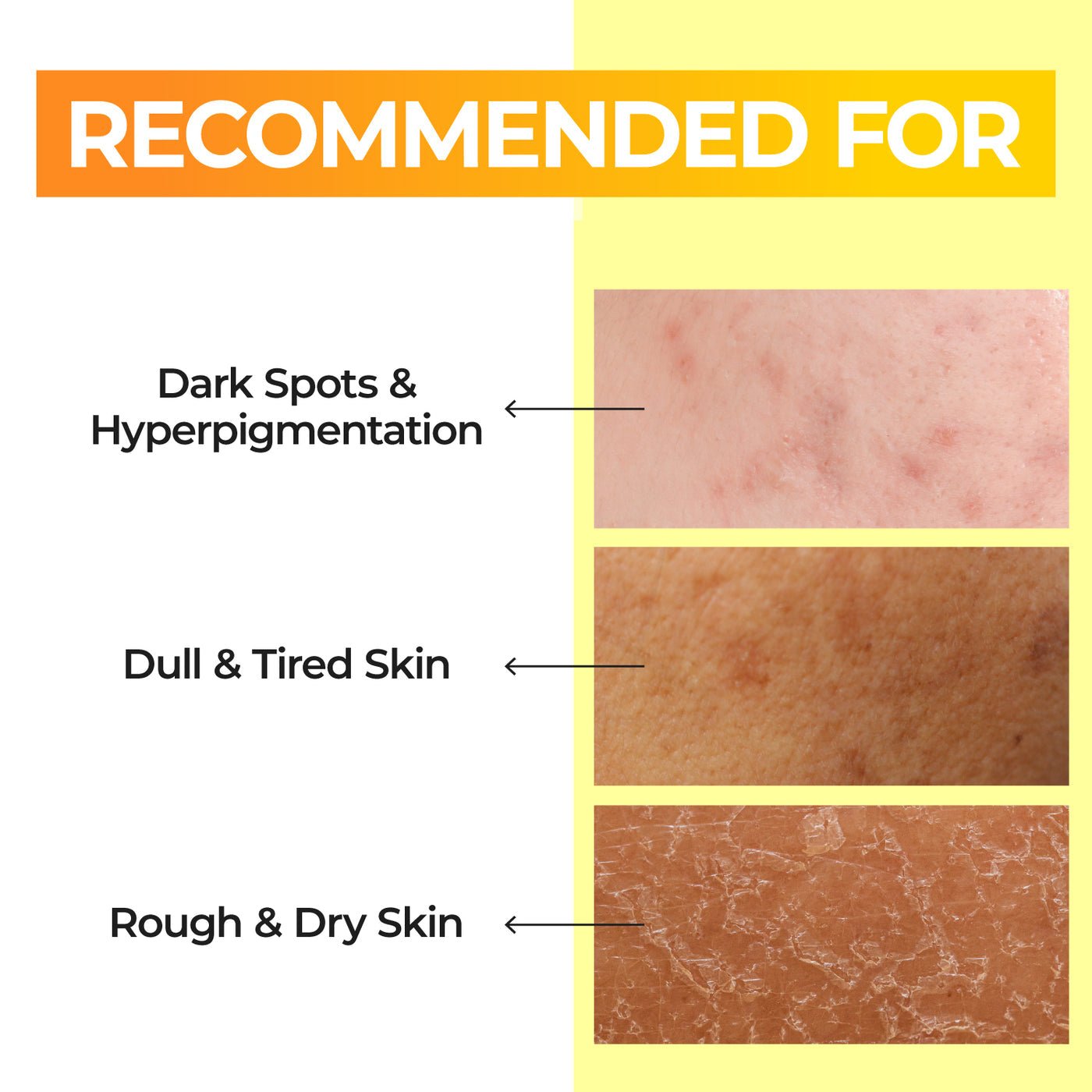 Numbuzin No. 5 Vitamin Boosting Essential Toner 200ml تونر نومبوزين رقم 5 المعزز بالفيتامينات الأساسية - Princess Cosmetics Qatar