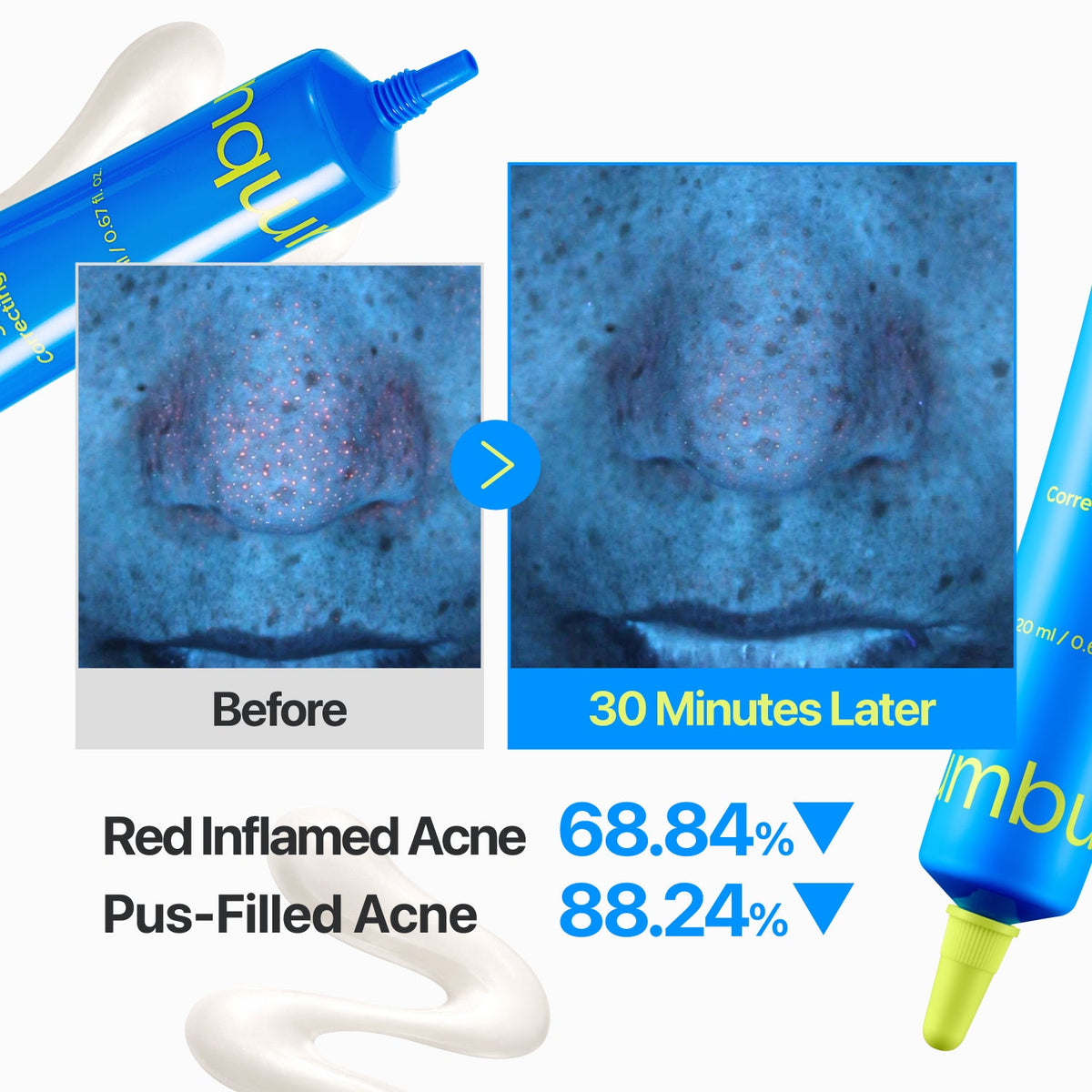 Numbuzin Zero Blemish 3X Spot Correcting Cream 20ml نومبوزين زيرو بليميش 3X كريم مصحح للبقع - Princess Cosmetics Qatar