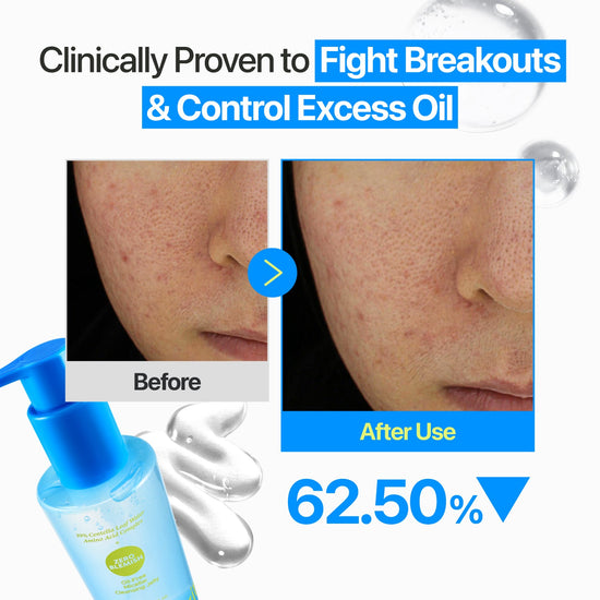 Numbuzin Zero Blemish Oil-Free Micellar Cleansing Jelly 200ml نومبوزين زيرو بليميش جل ميسيلار منظف خالٍ من الزيوت - Princess Cosmetics Qatar