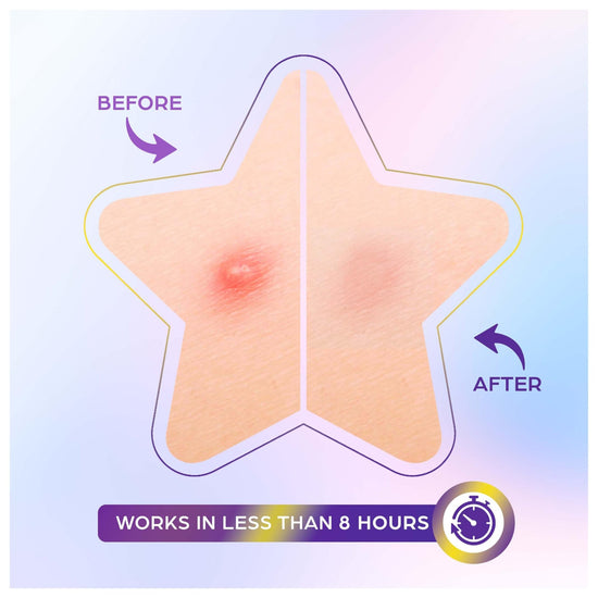 OOTD Star Spot Patch (80 Patches) رقعة نجمة OOTD - Princess Cosmetics Qatar