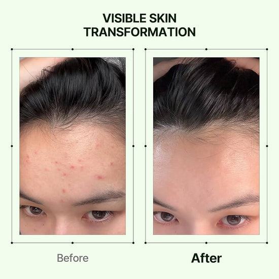 Orien Mugwort Zero Film Toner 160ml حبر أورين موغورت زيرو فيلم - Princess Cosmetics Qatar