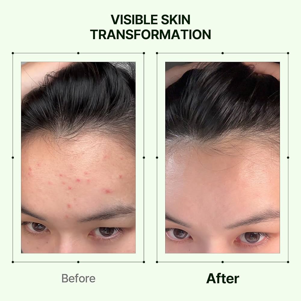 Orien Mugwort Zero Film Toner 160ml حبر أورين موغورت زيرو فيلم - Princess Cosmetics Qatar