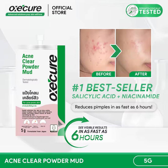 Oxecure Acne Clear Powder Mud 5g مسحوق الطين أوكسيكيور لعلاج حب الشباب - Princess Cosmetics Qatar