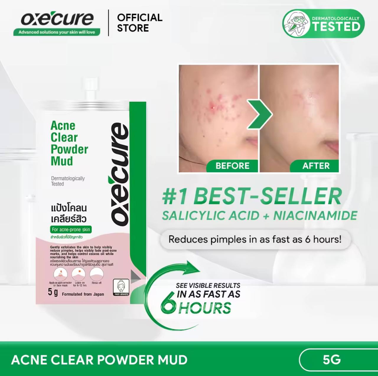 Oxecure Acne Clear Powder Mud 5g مسحوق الطين أوكسيكيور لعلاج حب الشباب - Princess Cosmetics Qatar