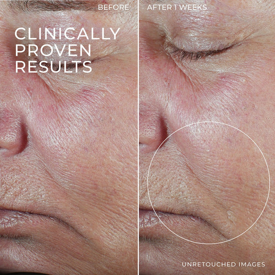 ROC Derm Correxion Firming Serum Stick 30g سيروم شد البشرة من روك ديرم كوريكشن - Princess Cosmetics Qatar