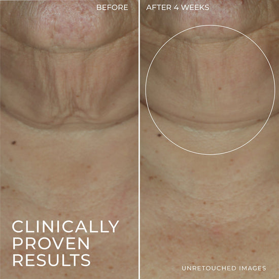 ROC Derm Correxion Firming Serum Stick 30g سيروم شد البشرة من روك ديرم كوريكشن - Princess Cosmetics Qatar