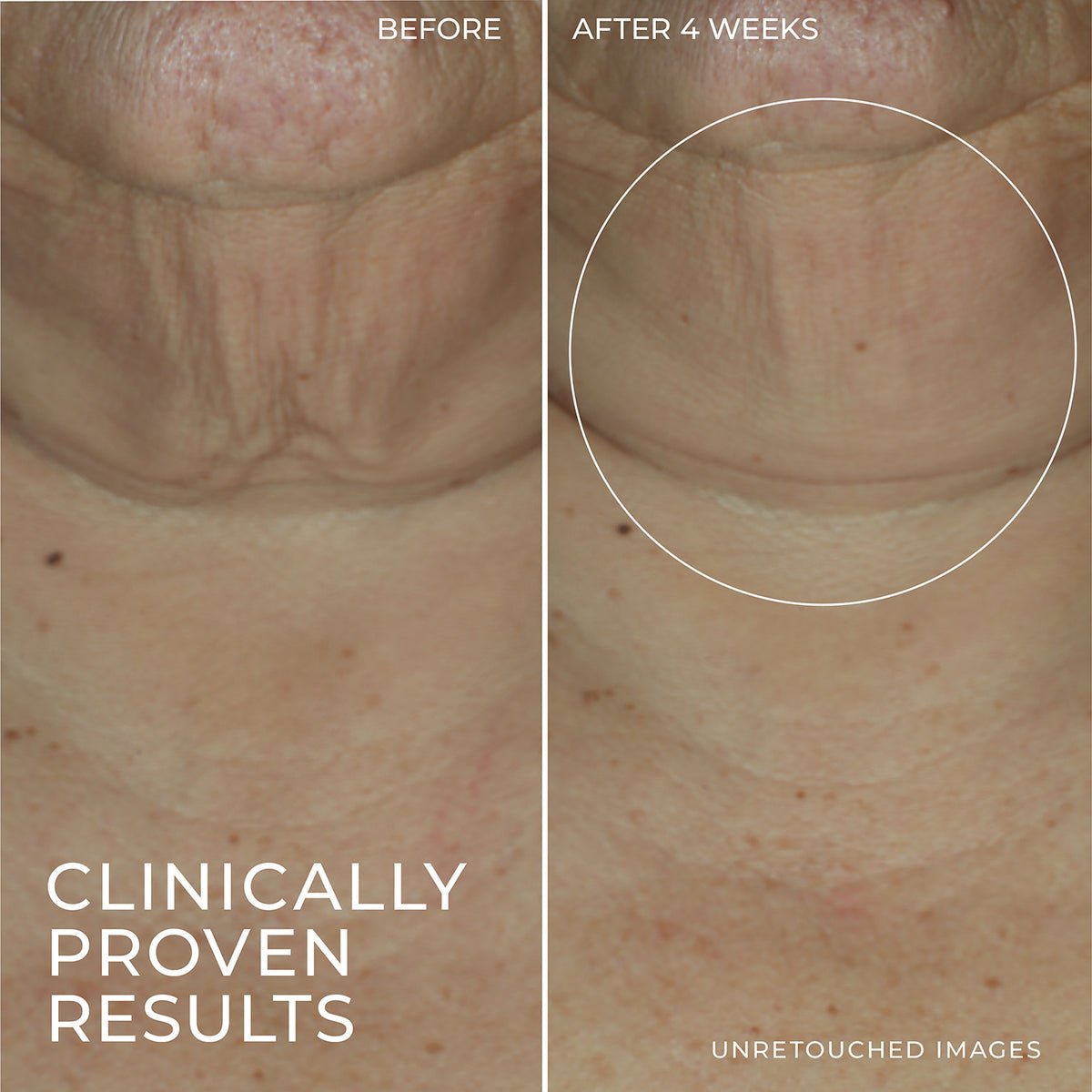 ROC Derm Correxion Firming Serum Stick 30g سيروم شد البشرة من روك ديرم كوريكشن - Princess Cosmetics Qatar