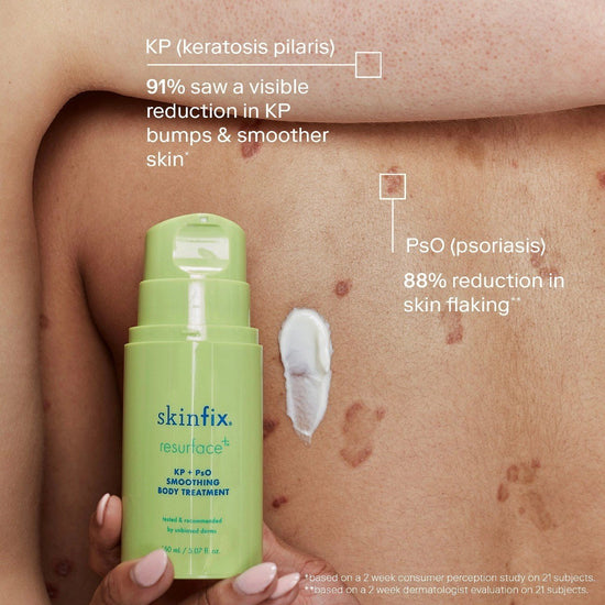 Skinfix KP + PsO Smoothing Body Treatment 150ml سكين فيكس KP + PsO علاج تنعيم الجسم - Princess Cosmetics Qatar