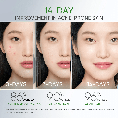 Skintific 3X Acid Anti-Acne Gel Moisturizer 30g سكينتفيك 3X حمض