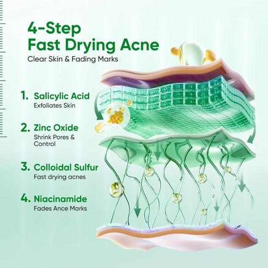 Skintific Acne Drying Lotion 10ml لوشن سكينتيفيك لتجفيف حب الشباب - Princess Cosmetics Qatar