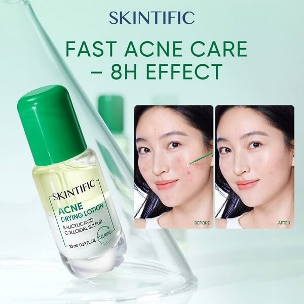 Skintific Acne Drying Lotion 10ml لوشن سكينتيفيك لتجفيف حب الشباب - Princess Cosmetics Qatar