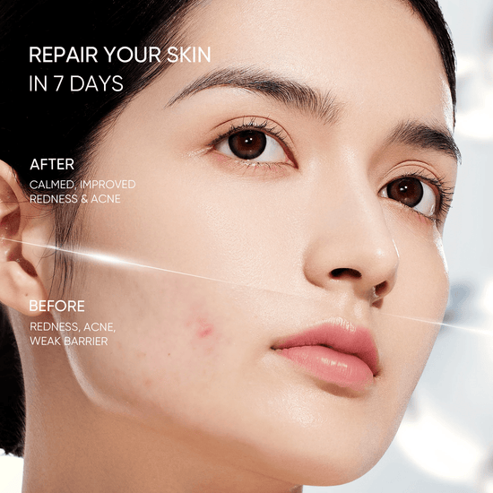 Skintific Sensitive Moisture Gel 40ml جل ترطيب البشرة الحساسة من سكينتيفيك - Princess Cosmetics Qatar