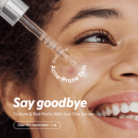 Tirtir Azelaic Acid 12% Serum 30ml سيروم حمض الأزيليك الصافي 12% - Princess Cosmetics Qatar