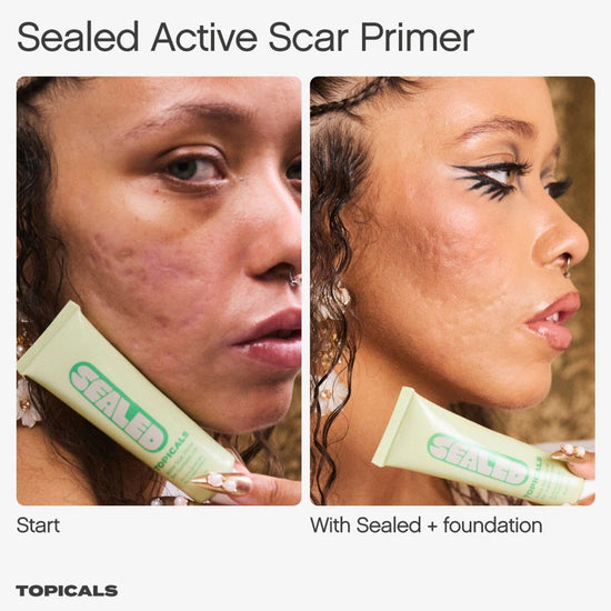 Topicals Sealed Active Scar Filling Primer for Acne Prone Skin 28ml. توبيكلس برايمر مختوم لملئ الندبات للبشرة المعرضة لحب الشباب 28 مل - Princess Cosmetics Qatar