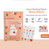Yukazan Hydrocolloid Acne Healing Patch لصقة يوكازان لعلاج حب الشباب بتقنية الهيدروكولويد - Princess Cosmetics Qatar