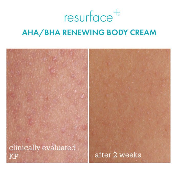 Skinfix Resurface+ AHA /BHA Renewing Cream 296ml سكين فيكس ريسيرفس + كريم تجديد AHA / BHA - Princess Cosmetics Qatar