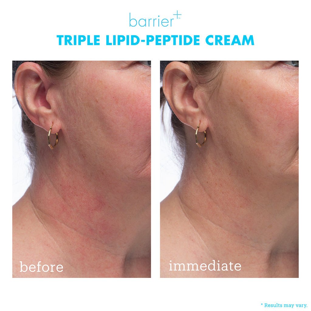 Skinfix Triple Lipid - Peptide Cream 50ml سكين فيكس كريم ثلاثي الدهون والببتيد - Princess Cosmetics Qatar